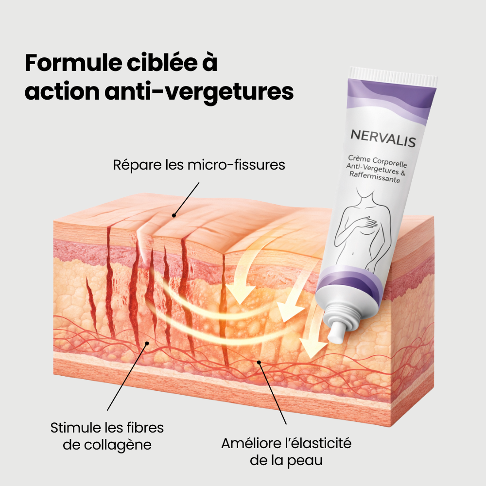 Nervalis Anti-Stretch Mark Cream