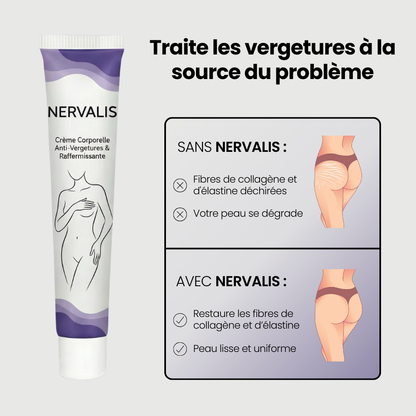 Nervalis Anti-Stretch Mark Cream